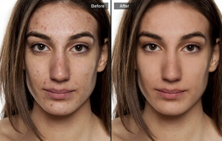 photo editor for clear skin
